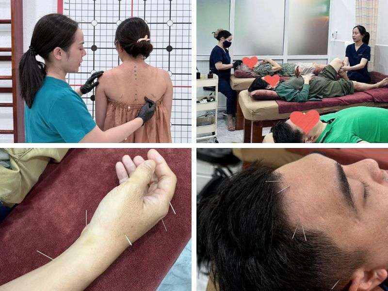Điều trị theo mô hình chăm sóc và phục hồi 4 tầng